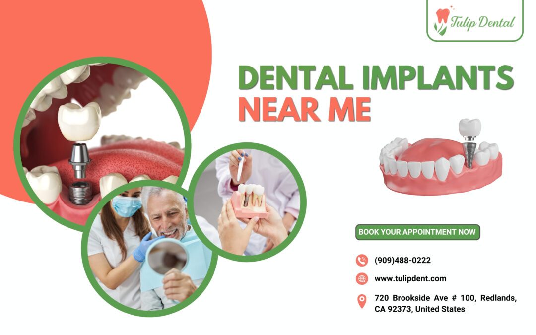 Dental implants near me offered by Tulip Dent for safe and natural tooth replacement