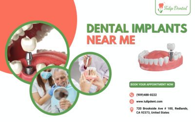 Dental Implants Near Me: Your Path to a Confident Smile