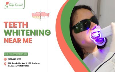 Finding the Best Teeth Whitening Near Me: A Complete Guide
