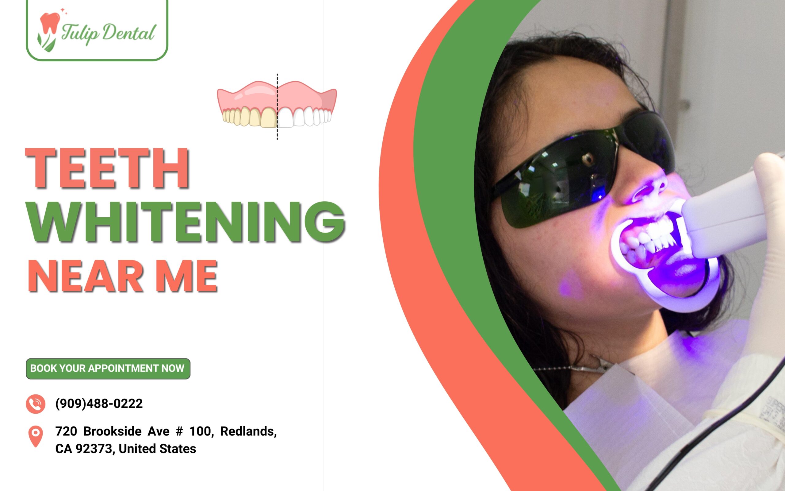 Teeth whitening near me