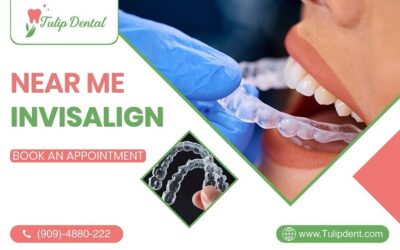 Near Me Invisalign: Discover Your Perfect Smile with Tulip Dental