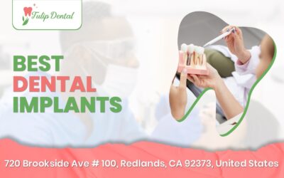 Best Dental Implants: 6 LifeChanging Benefits for a Stronger Healthier Smile