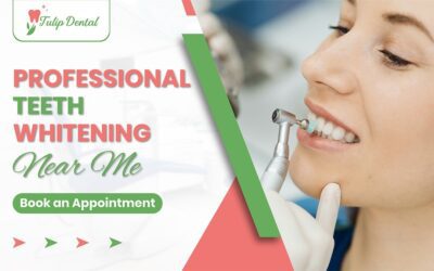 7 Proven Benefits of the Professional Teeth Whitening Near Me for a Brighter, Confident Smile