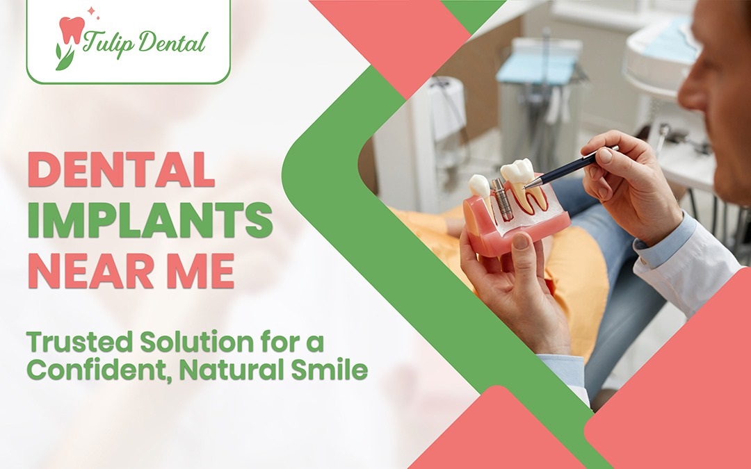 Dental Implants near me | Full Mouth Dental Implants – Tulip Dental