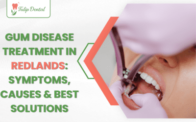Gum Disease Treatment in Redlands: Symptoms, Causes & Best Solutions