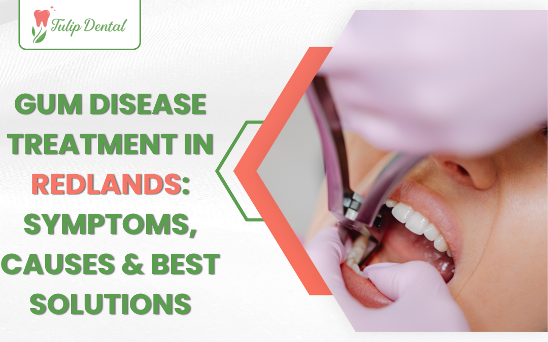 Gum disease treatment in Redlands