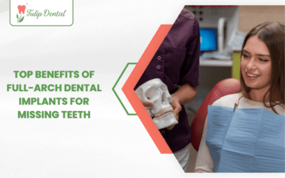 Top Benefits of Full-Arch Dental Implants for Missing Teeth