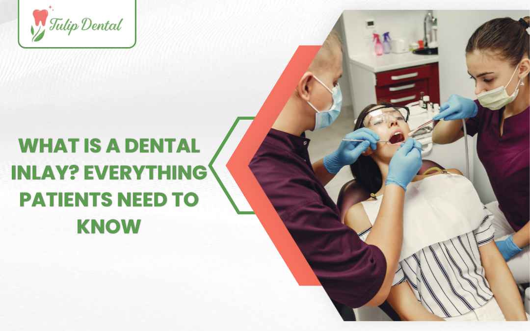 What Is a Dental Inlay? Everything Patients Need to Know