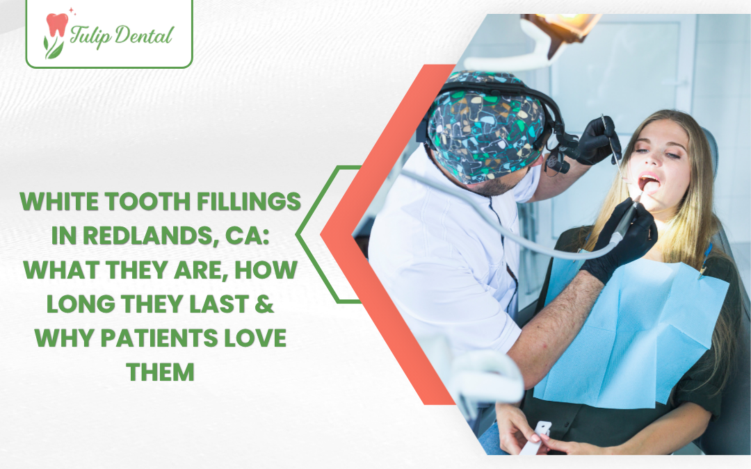 White Tooth Fillings in Redlands, CA: What They Are, How Long They Last & Why Patients Love Them