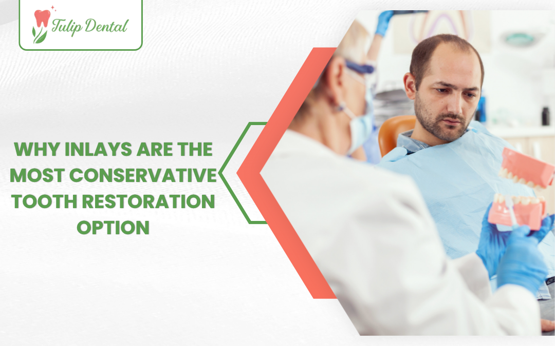 Why Inlays Are the Most Conservative Tooth Restoration Option