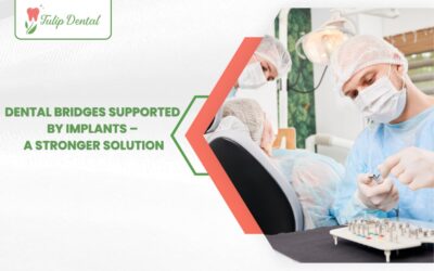Dental Bridges Supported by Implants – A Stronger Solution
