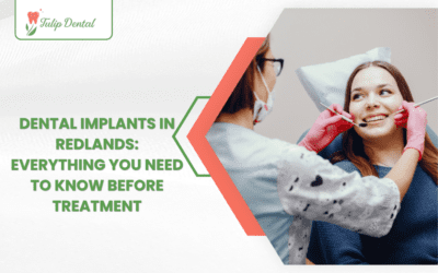 Dental Implants in Redlands: Everything You Need to Know Before Treatment