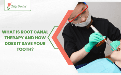 What Is Root Canal Therapy and How Does It Save Your Tooth?