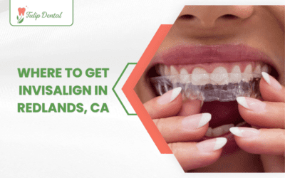 Where to Get Invisalign in Redlands, CA