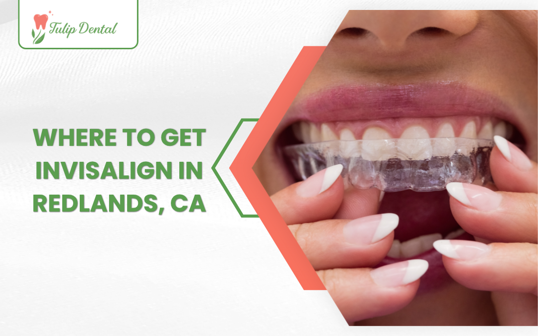 Where to Get Invisalign in Redlands, CA