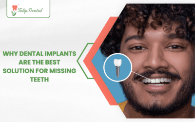 Why Dental Implants Are the Best Solution for Missing Teeth