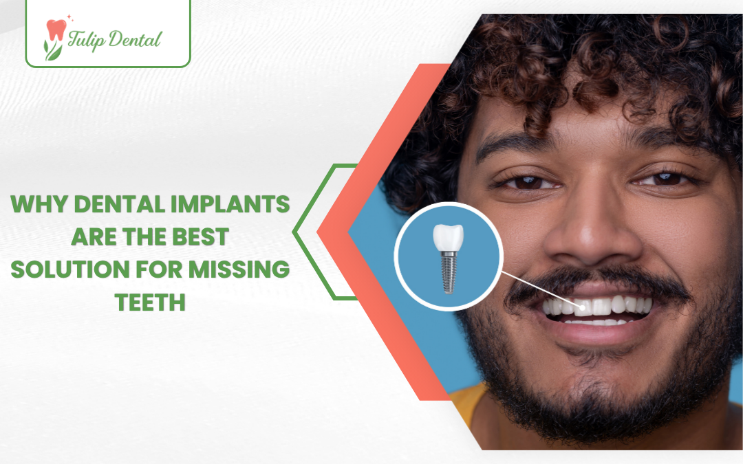 A professional dental implant model showing a porcelain crown attached to a titanium post replacing a missing tooth root.