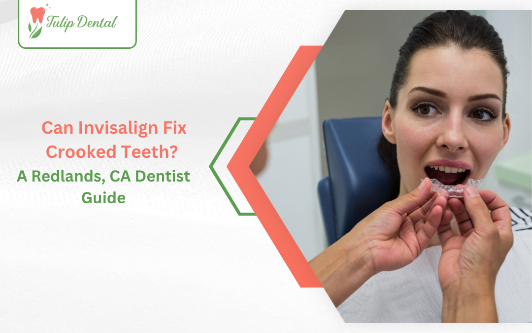 Can Invisalign Fix Crooked Teeth? A Redlands, CA Dentist Guide