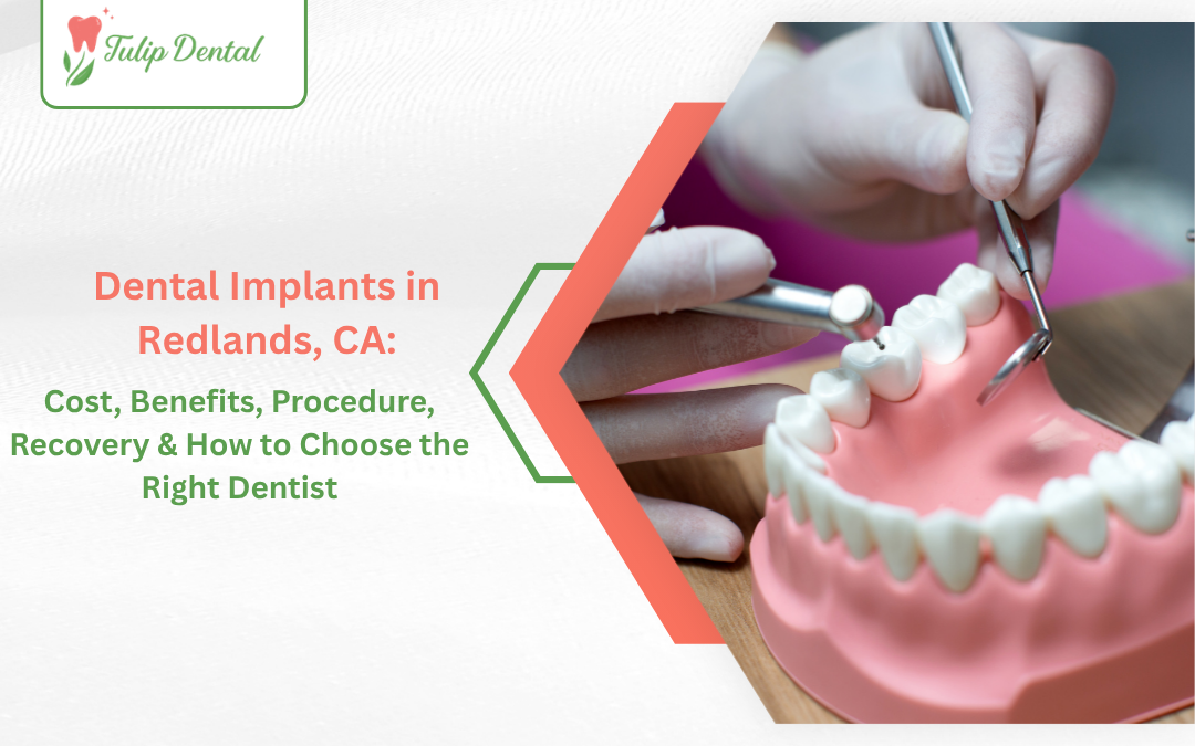 Dental Implants in Redlands, CA: Cost, Benefits, Procedure, Recovery & How to Choose the Right Dentist