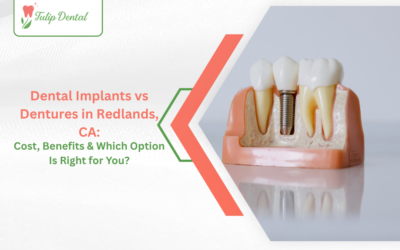 Dental Implants vs Dentures in Redlands, CA: Cost, Benefits & Which Option Is Right for You?