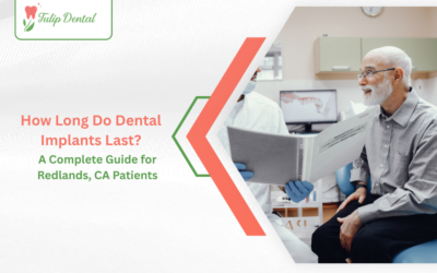 How Long Do Dental Implants Last? A Complete Guide for Redlands, CA Patients