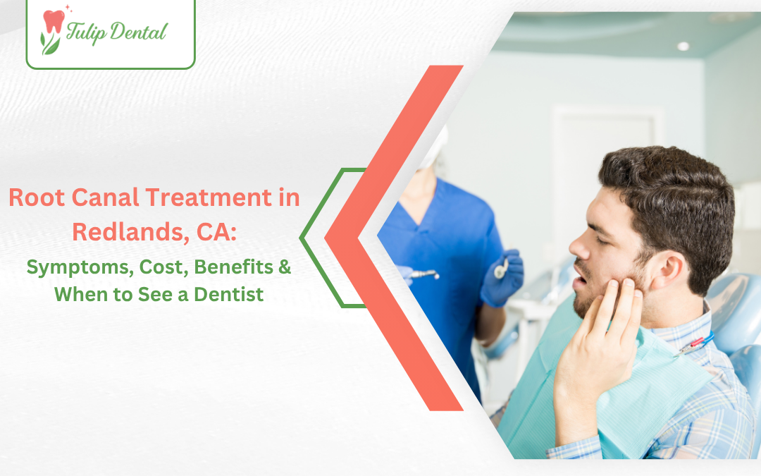 Root Canal Treatment in Redlands, CA: Symptoms, Cost, Benefits & When to See a Dentist