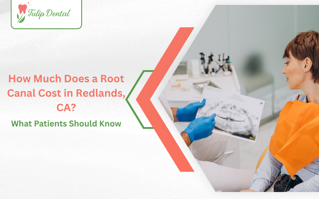 How Much Does a Root Canal Cost in Redlands, CA? What Patients Should Know