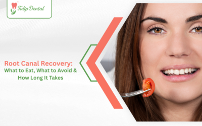 Root Canal Recovery: What to Eat, What to Avoid & How Long It Takes